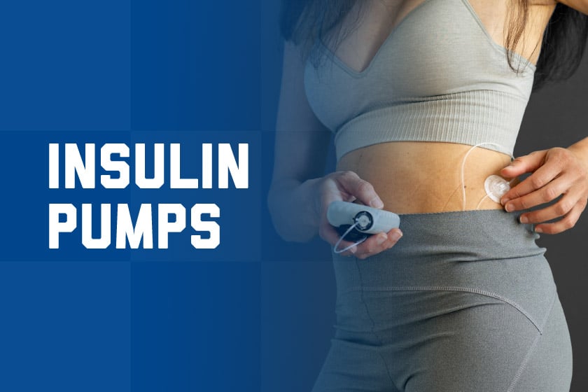 A woman with an insulin pump on her torso