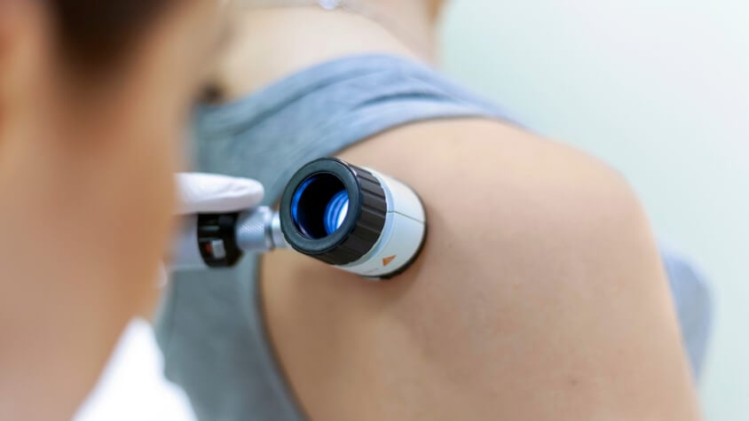 A person getting a skin check