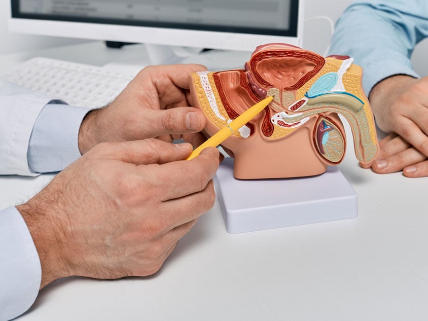 A health professional pointing to a prostate model